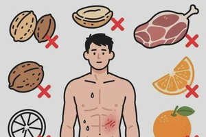 男人肚子上偶尔长湿疹什么东西最好不吃